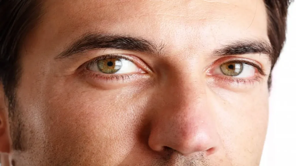 surgical options for Male Blepharoplasty